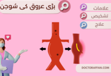 Abdominal Aortic Aneurysm پیٹ کے بڑے عروقی کی سُوجن