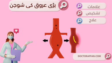 Abdominal Aortic Aneurysm پیٹ کے بڑے عروقی کی سُوجن