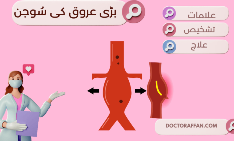 Abdominal Aortic Aneurysm پیٹ کے بڑے عروقی کی سُوجن