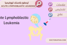 Acute Lymphoblastic Leukemia