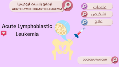 Acute Lymphoblastic Leukemia