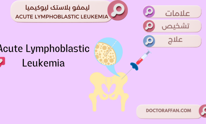 Acute Lymphoblastic Leukemia