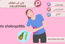 Acute cholecystitis Causes, Treatment, Diagnosis in urdu