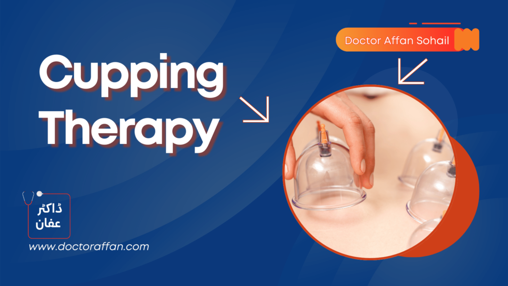 Cupping Therapy in Urdu