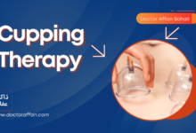 Cupping Therapy in Urdu