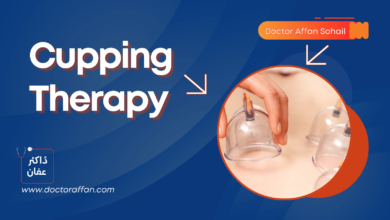 Cupping Therapy in Urdu