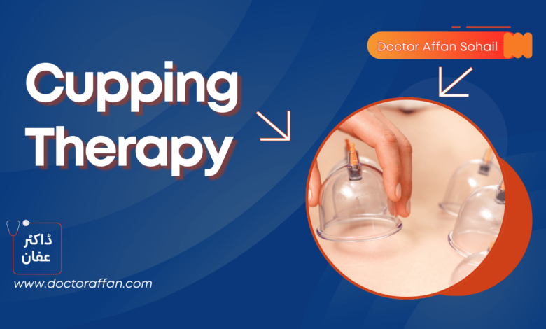 Cupping Therapy in Urdu