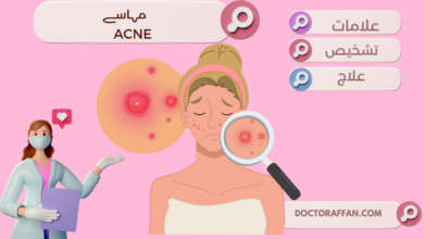 Acne causes and treatment in urdu