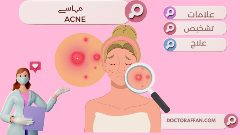 Acne causes and treatment in urdu